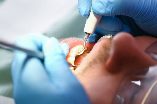 Best Weekend Emergency Dentist in Monroe, LA