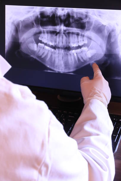Best Emergency Tooth Extraction in Monroe, LA